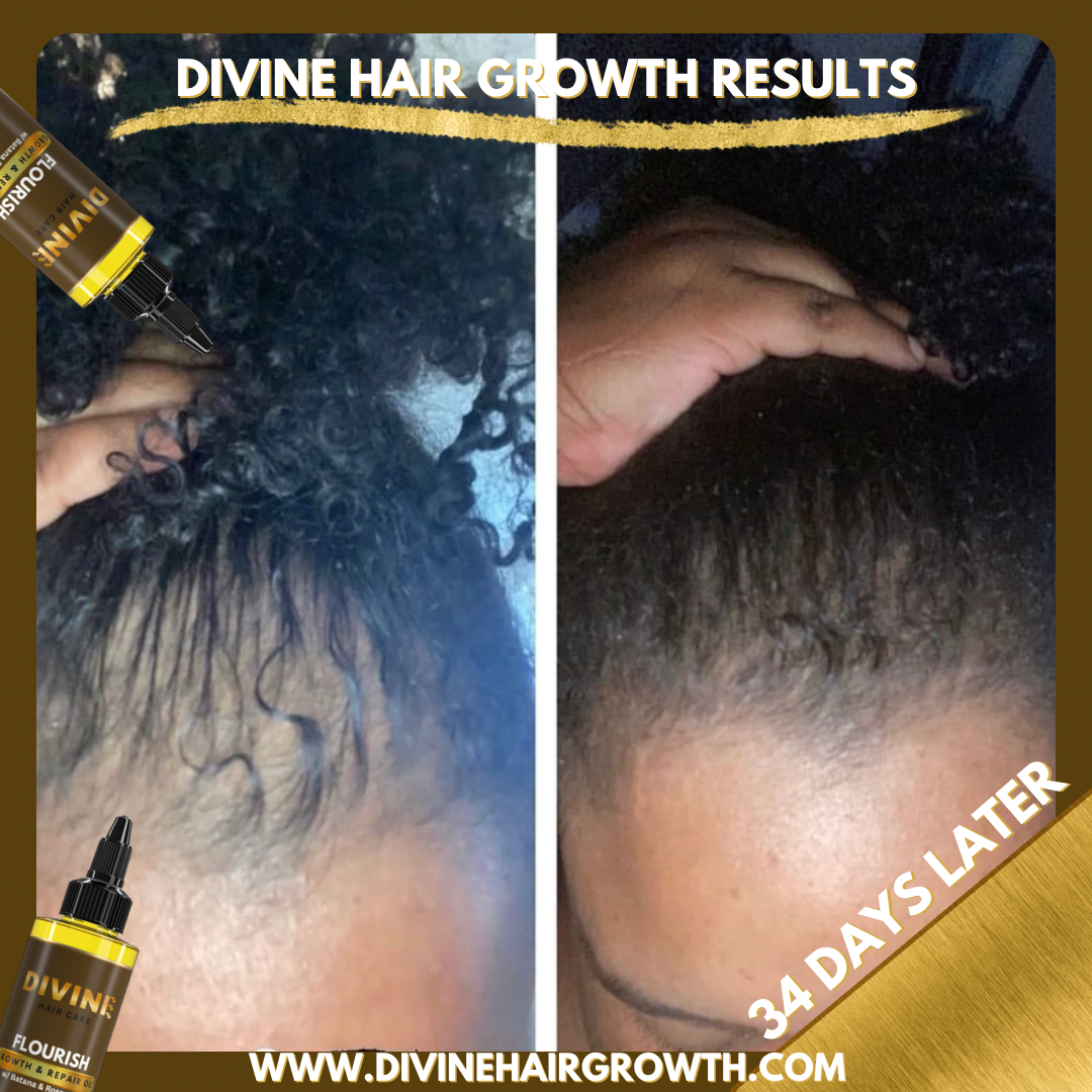 “FLOURISH” Premium Hair Growth Oil